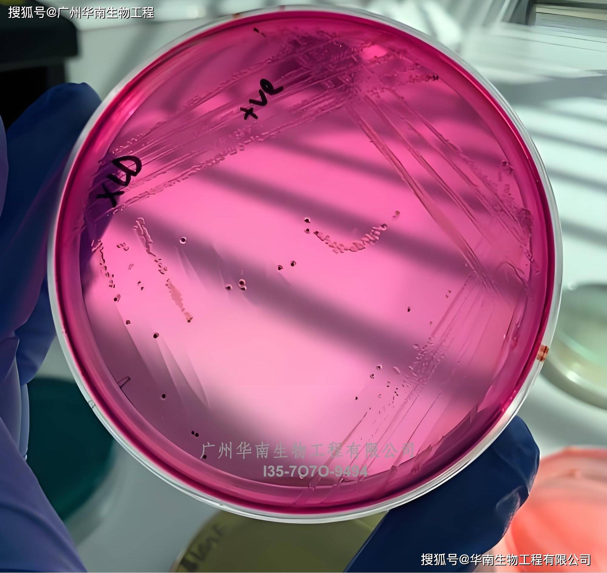 丹(dān)麦ssi中国官网中文(wén)版